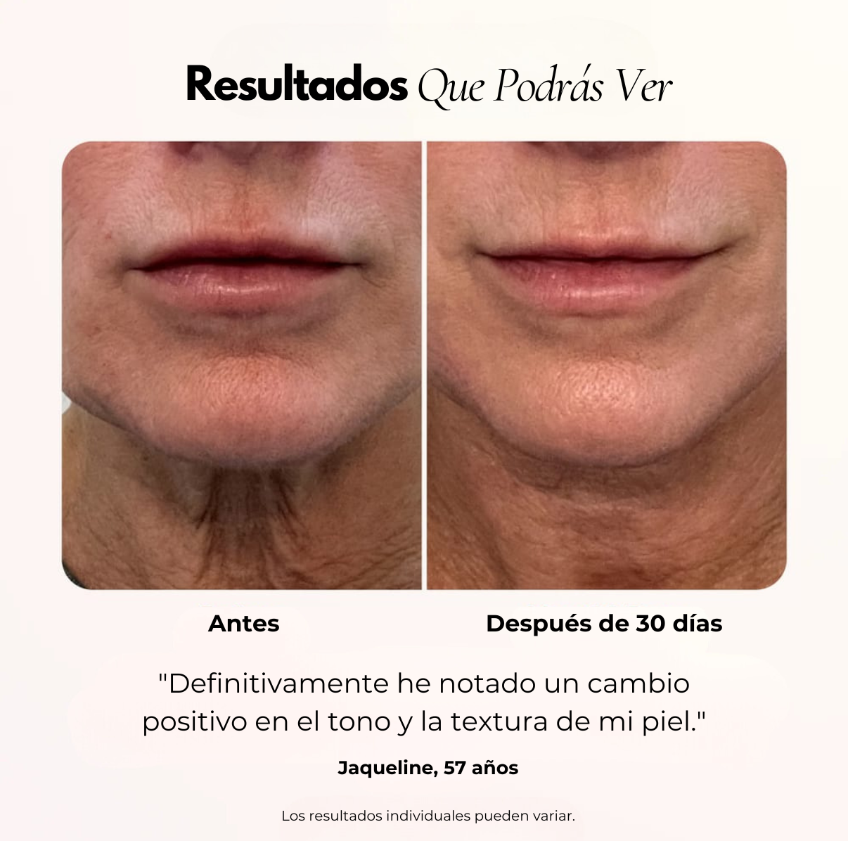 Luminis 4D ™ Terapia Facial LED antiarrugas y manchas