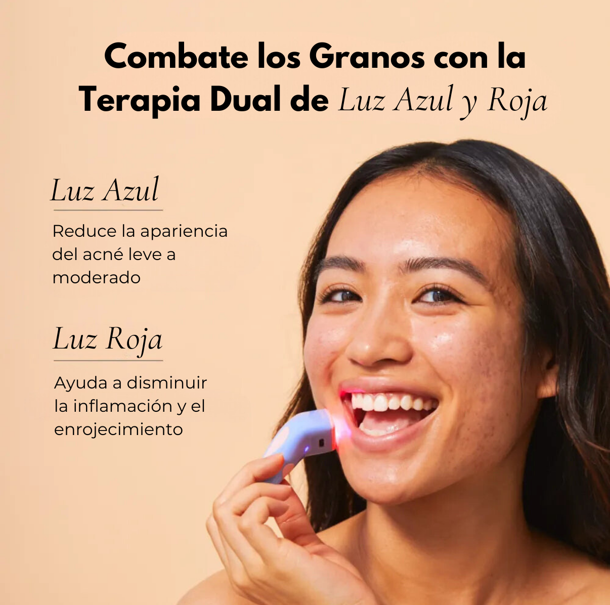 Bye Acné™ Tratamiento para las espinillas en 3 minutos